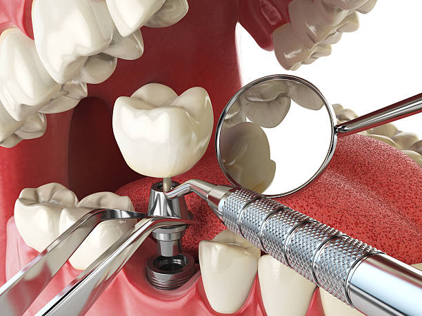 Best Dentist for Dental Trauma  in USA